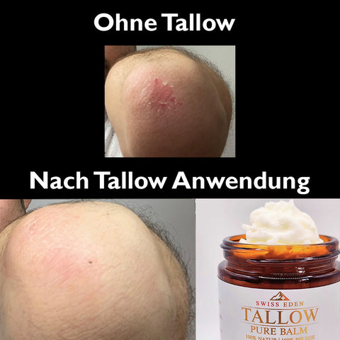 Schweizer Talgbalsam Ren – 100% Demeter Økologisk Storfe-Talg uten tilsetninger fra Swiss Eden