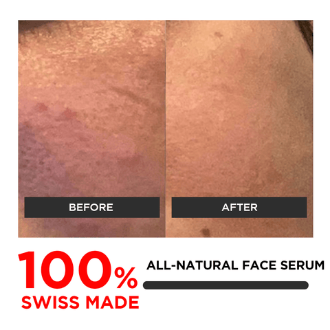 Sérum Facial Elixir Perfecto para la Piel 30ml